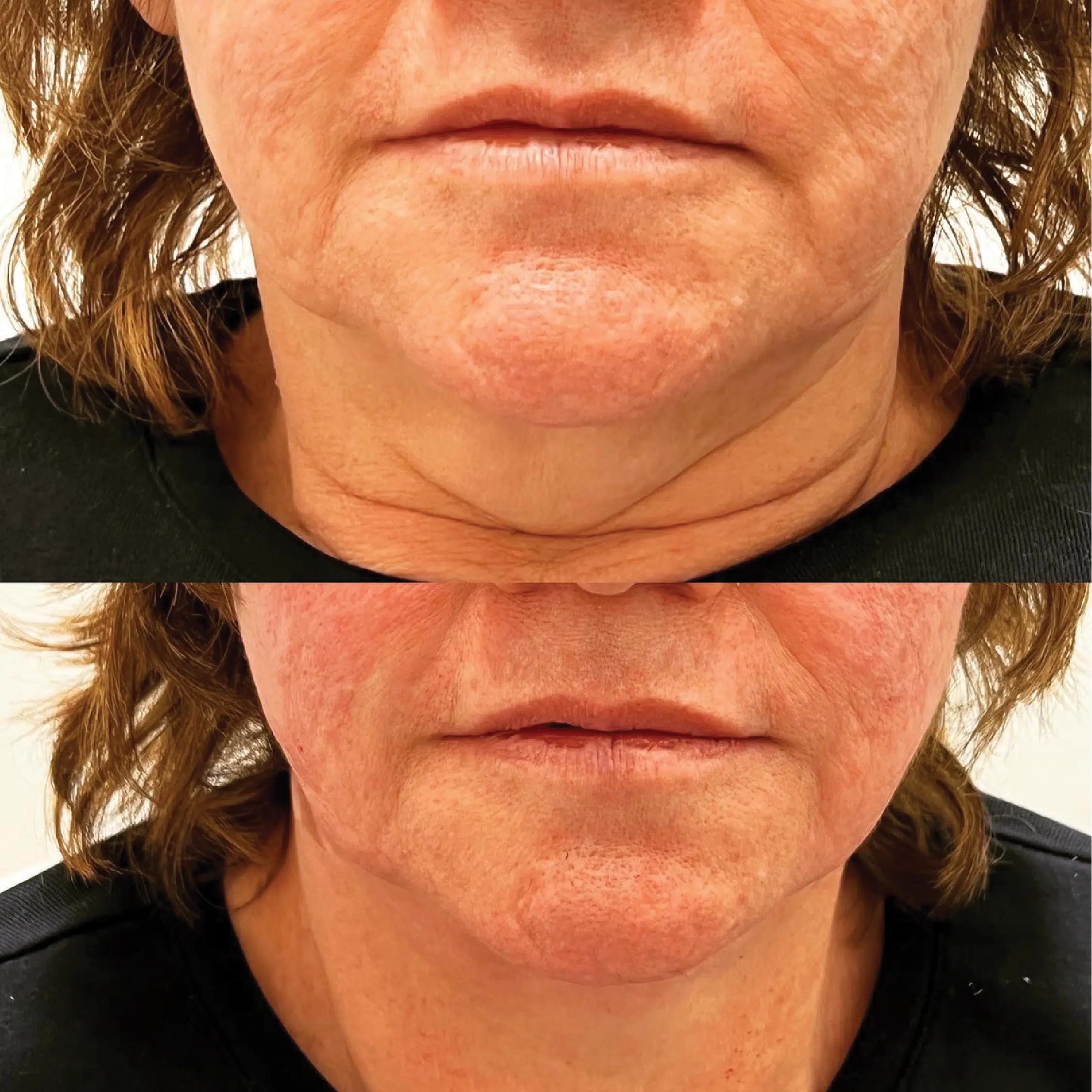 Before And After
